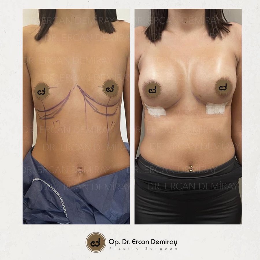 Dr Ercan Demiray MD, Aesthetic and Plastic Surgeon - Dr Ercan Demiray MD, Aesthetic and Plastic Surgeon