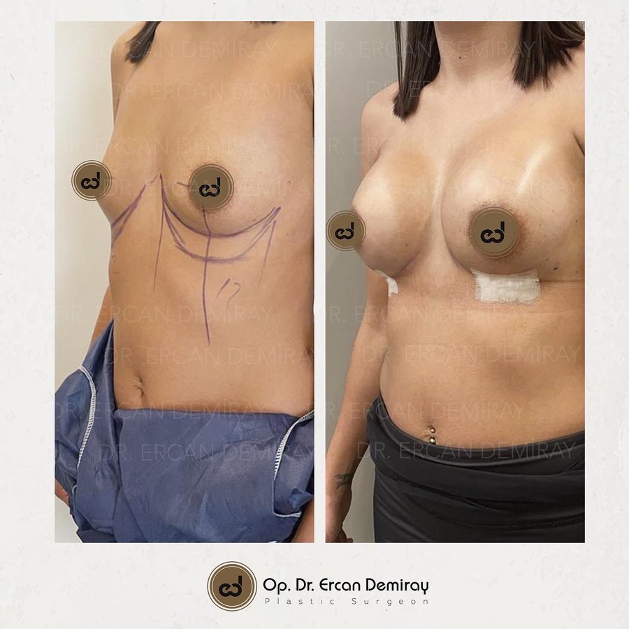 Dr Ercan Demiray MD, Aesthetic and Plastic Surgeon - Dr Ercan Demiray MD, Aesthetic and Plastic Surgeon