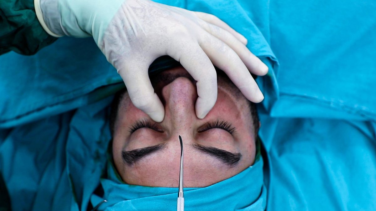 Dr Ercan Demiray MD, Aesthetic and Plastic Surgeon - Dr Ercan Demiray MD, Aesthetic and Plastic Surgeon