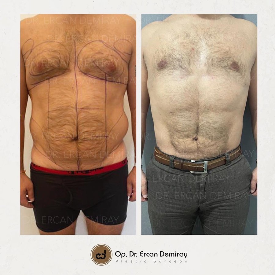 Dr Ercan Demiray MD, Aesthetic and Plastic Surgeon - Dr Ercan Demiray MD, Aesthetic and Plastic Surgeon