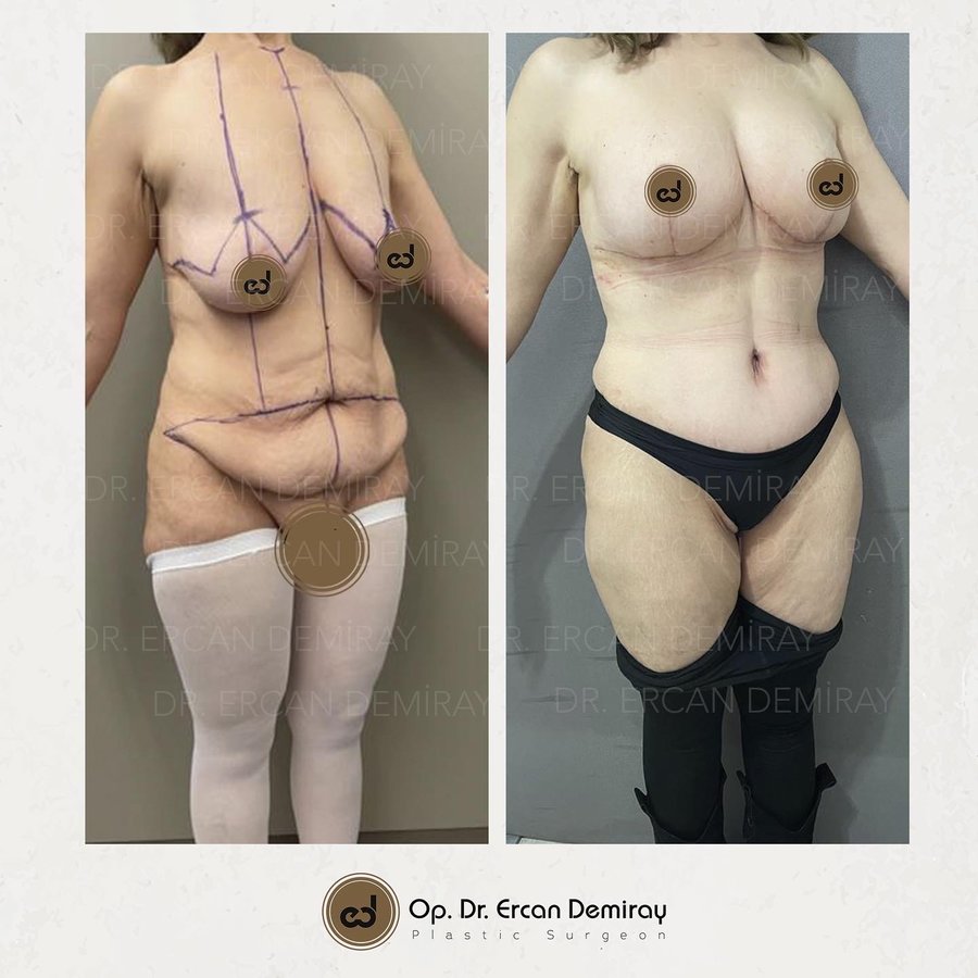 Dr Ercan Demiray MD, Aesthetic and Plastic Surgeon - Dr Ercan Demiray MD, Aesthetic and Plastic Surgeon