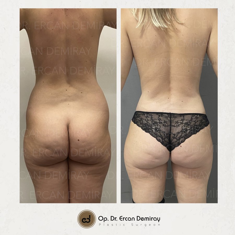 Dr Ercan Demiray MD, Aesthetic and Plastic Surgeon - Dr Ercan Demiray MD, Aesthetic and Plastic Surgeon