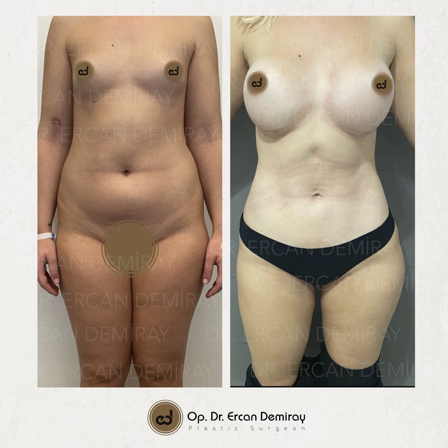 Dr Ercan Demiray MD, Aesthetic and Plastic Surgeon - Dr Ercan Demiray MD, Aesthetic and Plastic Surgeon