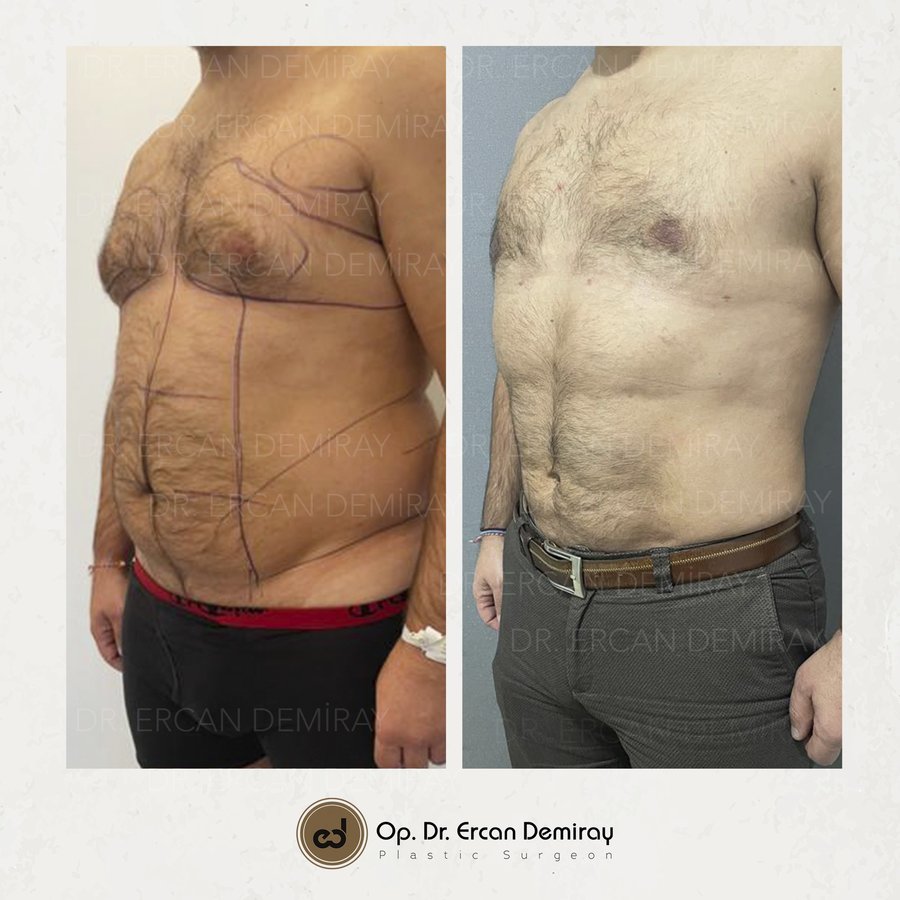 Dr Ercan Demiray MD, Aesthetic and Plastic Surgeon - Dr Ercan Demiray MD, Aesthetic and Plastic Surgeon