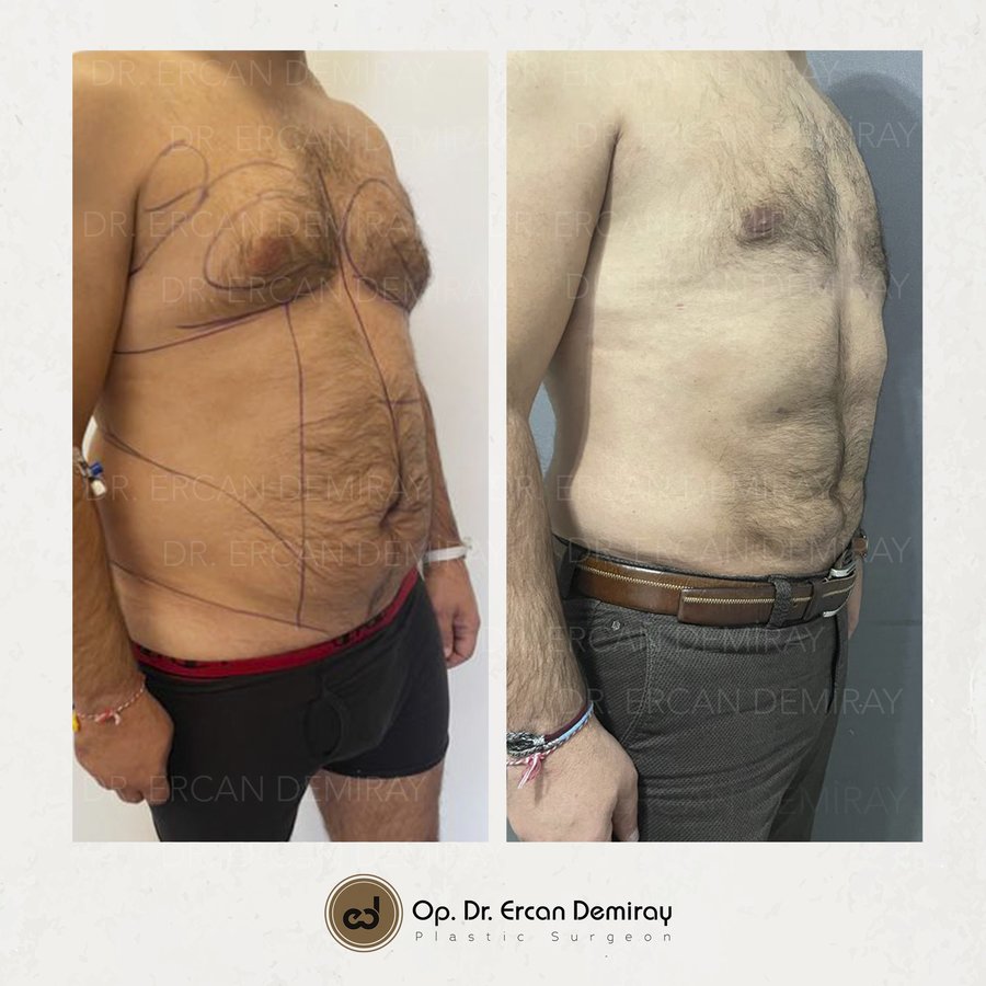 Dr Ercan Demiray MD, Aesthetic and Plastic Surgeon - Dr Ercan Demiray MD, Aesthetic and Plastic Surgeon