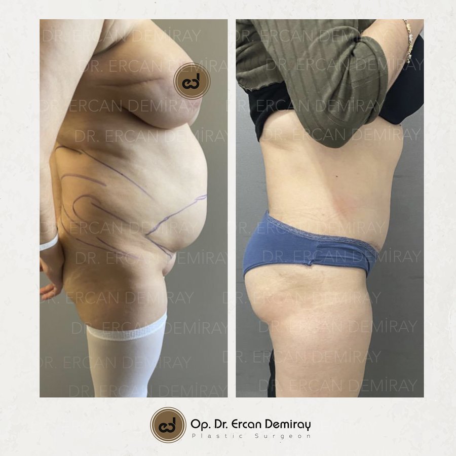 Dr Ercan Demiray MD, Aesthetic and Plastic Surgeon - Dr Ercan Demiray MD, Aesthetic and Plastic Surgeon