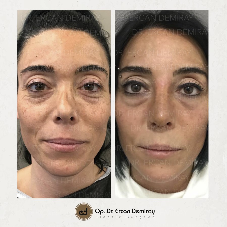 Dr Ercan Demiray MD, Aesthetic and Plastic Surgeon - Dr Ercan Demiray MD, Aesthetic and Plastic Surgeon