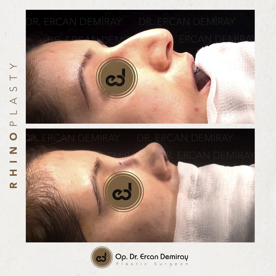 Dr Ercan Demiray MD, Aesthetic and Plastic Surgeon - Dr Ercan Demiray MD, Aesthetic and Plastic Surgeon