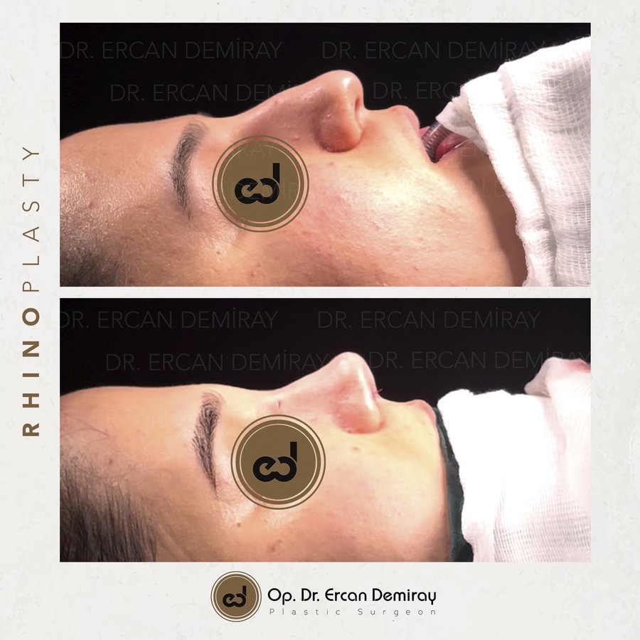 Dr Ercan Demiray MD, Aesthetic and Plastic Surgeon - Dr Ercan Demiray MD, Aesthetic and Plastic Surgeon