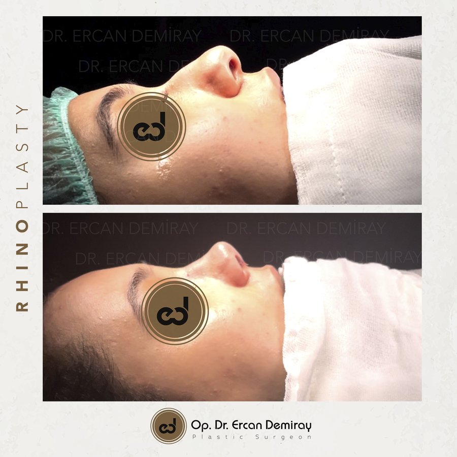 Dr Ercan Demiray MD, Aesthetic and Plastic Surgeon - Dr Ercan Demiray MD, Aesthetic and Plastic Surgeon