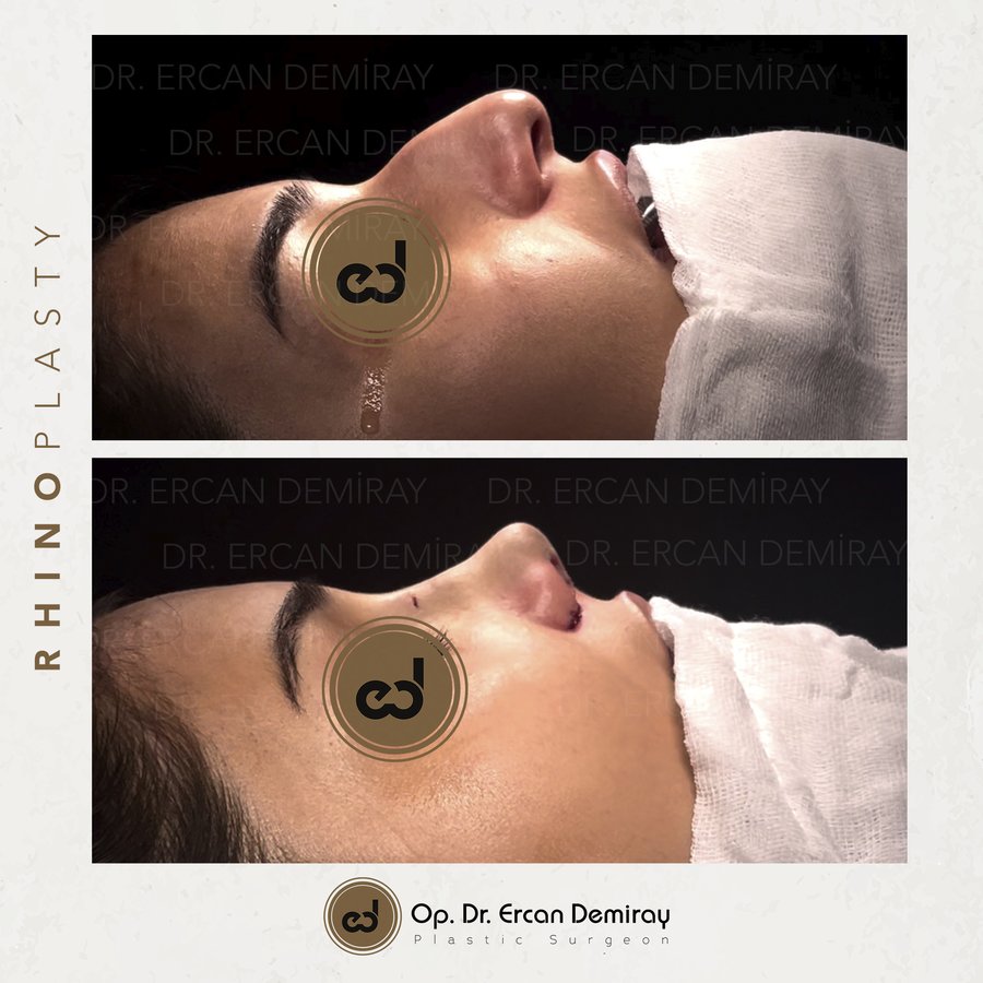 Dr Ercan Demiray MD, Aesthetic and Plastic Surgeon - Dr Ercan Demiray MD, Aesthetic and Plastic Surgeon