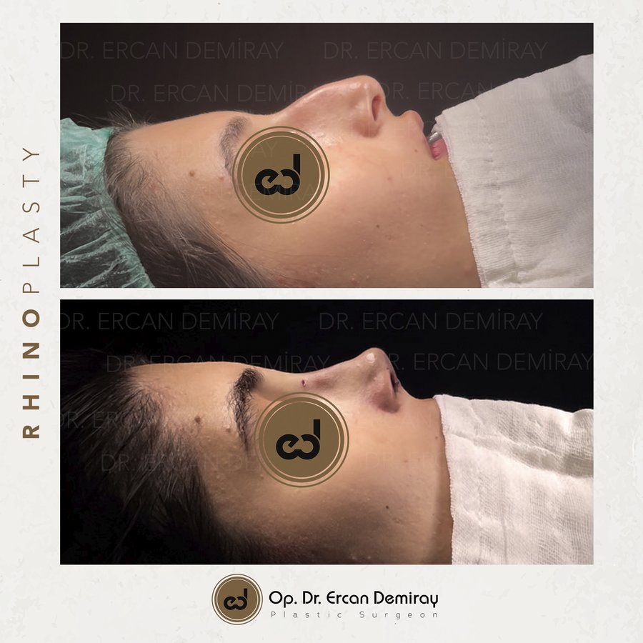 Dr Ercan Demiray MD, Aesthetic and Plastic Surgeon - Dr Ercan Demiray MD, Aesthetic and Plastic Surgeon