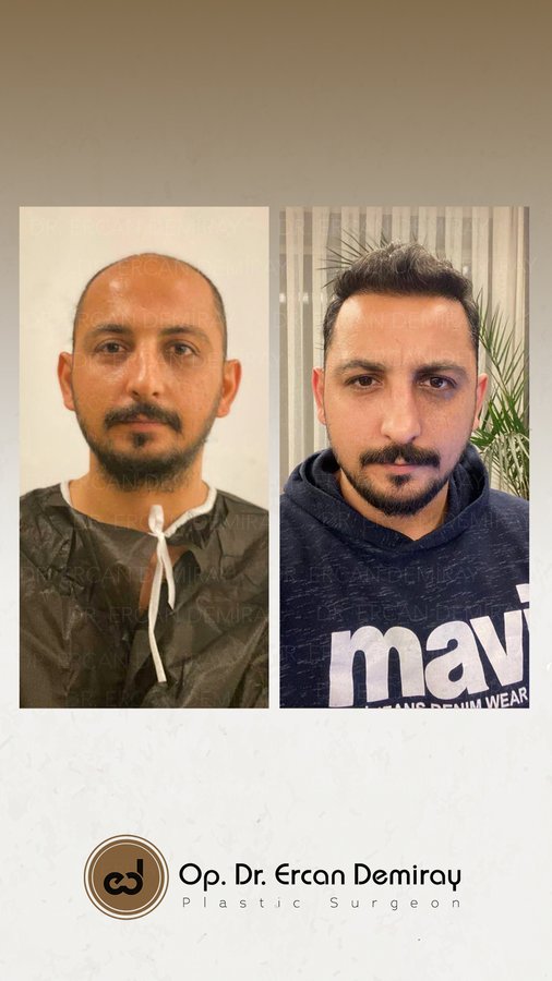 Dr Ercan Demiray MD, Aesthetic and Plastic Surgeon - Dr Ercan Demiray MD, Aesthetic and Plastic Surgeon