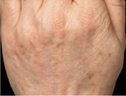Dr. Eric Berkowitz MD - Dr. Eric Berkowitz MD