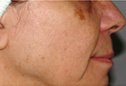 Dr. Eric Berkowitz MD - Dr. Eric Berkowitz MD