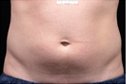 Dr. Eric Berkowitz MD - Dr. Eric Berkowitz MD