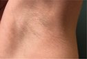 Dr. Eric Berkowitz MD - Dr. Eric Berkowitz MD
