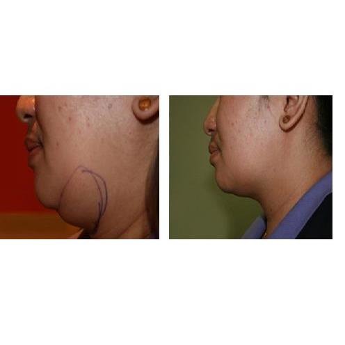 Dr. Fadi Nasr Cosmetic and Dermatologic Surgeon - Dr. Fadi Nasr Cosmetic and Dermatologic Surgeon