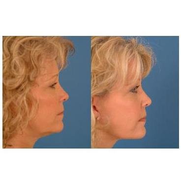 Dr. Fadi Nasr Cosmetic and Dermatologic Surgeon - Dr. Fadi Nasr Cosmetic and Dermatologic Surgeon