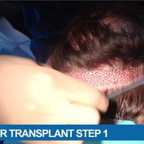 Dr. Fadi Nasr Cosmetic and Dermatologic Surgeon - Dr. Fadi Nasr Cosmetic and Dermatologic Surgeon