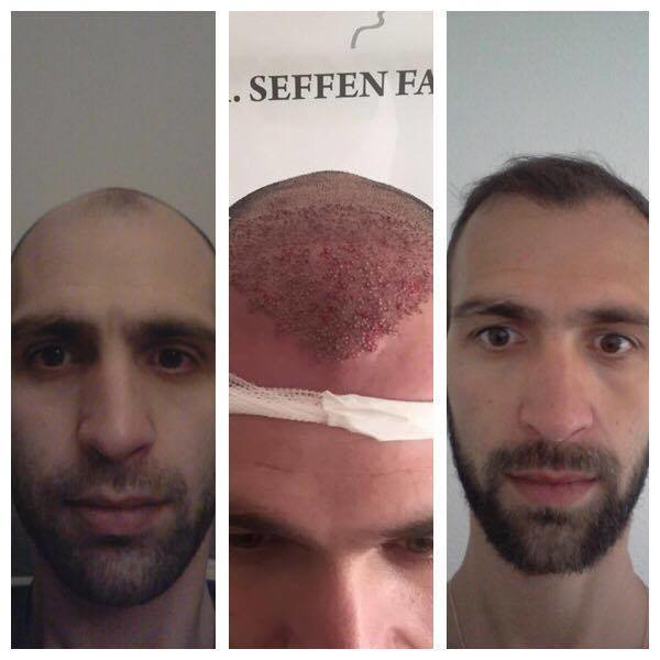 عيادة الدكتور فارس سيفن - Dr Fares Seffen clinic
