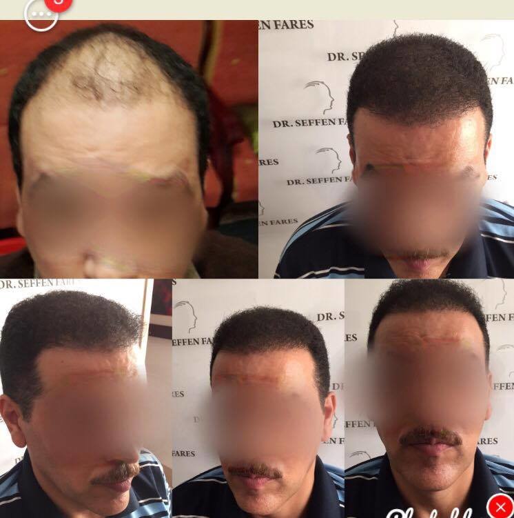 عيادة الدكتور فارس سيفن - Dr Fares Seffen clinic