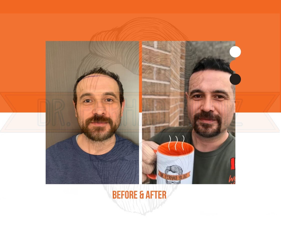 Dr. Ferhad YILDIZ - Dr. Ferhad YILDIZ