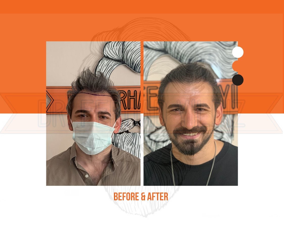 Dr. Ferhad YILDIZ - Dr. Ferhad YILDIZ