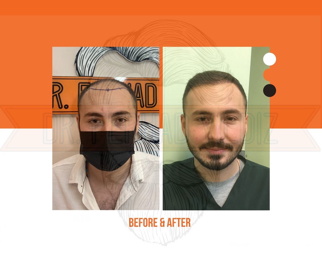 Dr. Ferhad YILDIZ - Dr. Ferhad YILDIZ