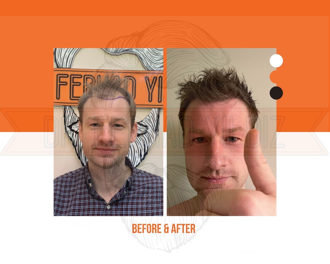 Dr. Ferhad YILDIZ - Dr. Ferhad YILDIZ