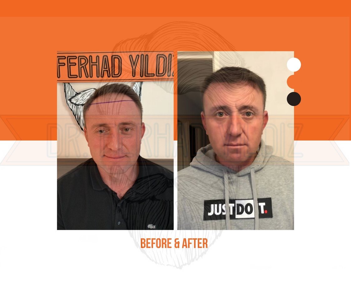 Dr. Ferhad YILDIZ - Dr. Ferhad YILDIZ