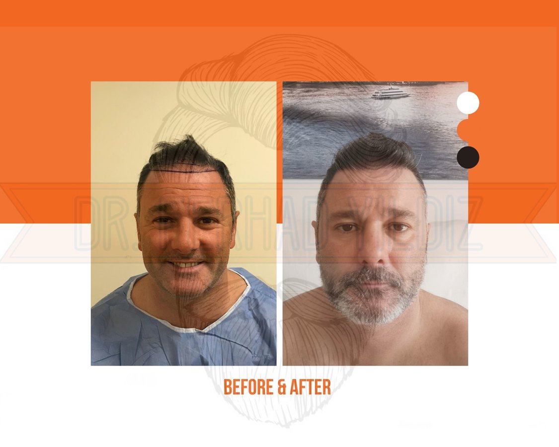 Dr. Ferhad YILDIZ - Dr. Ferhad YILDIZ