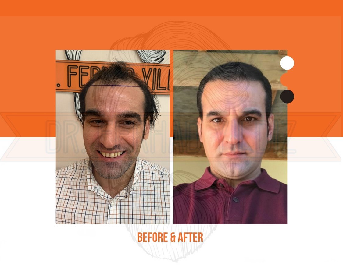Dr. Ferhad YILDIZ - Dr. Ferhad YILDIZ