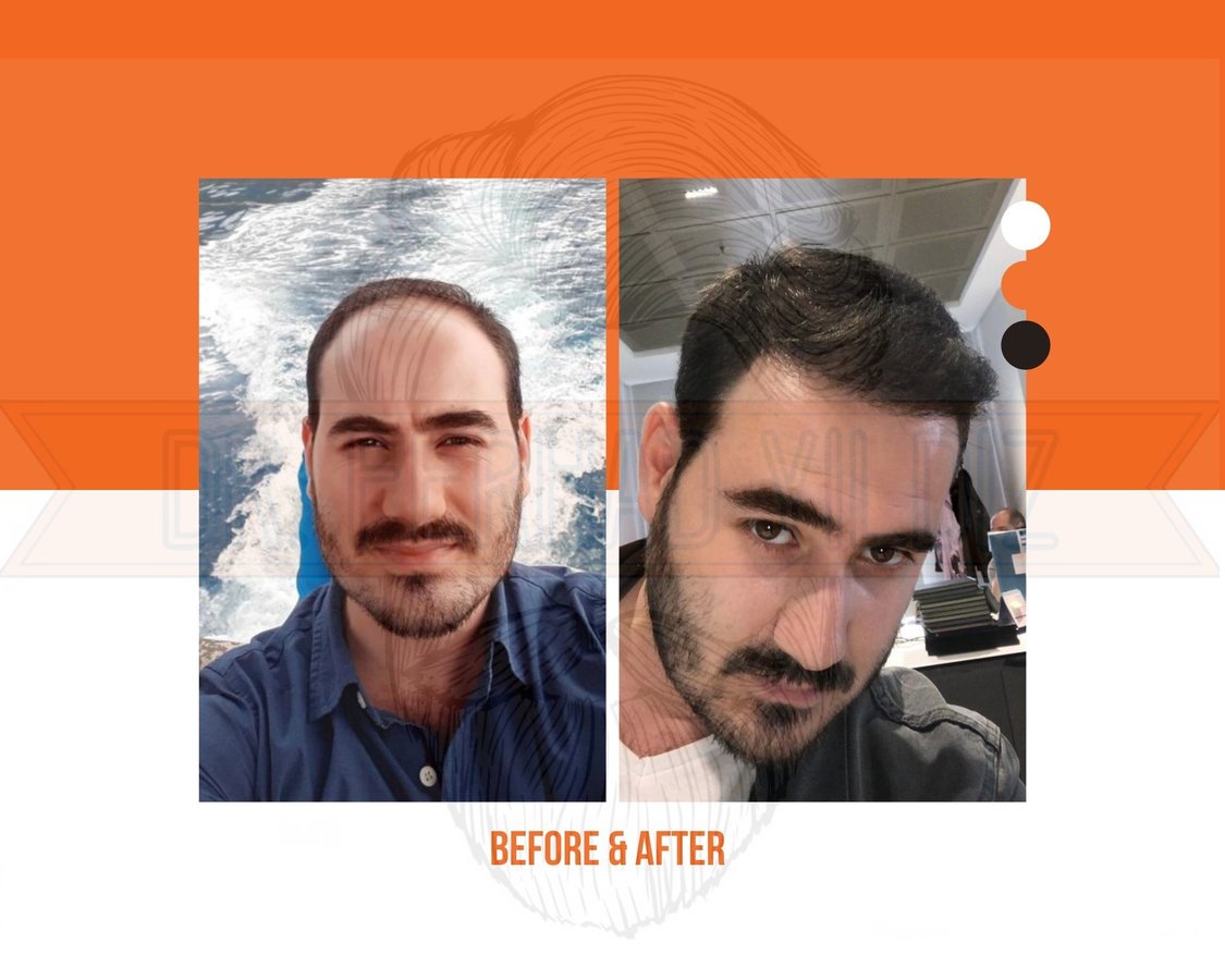 Dr. Ferhad YILDIZ - Dr. Ferhad YILDIZ