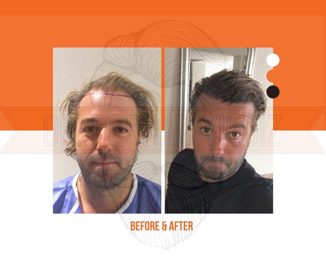 Dr. Ferhad YILDIZ - Dr. Ferhad YILDIZ