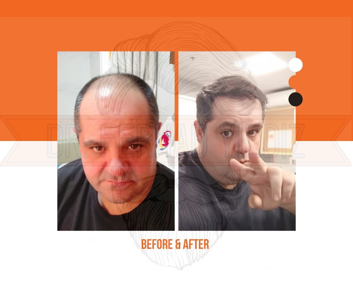 Dr. Ferhad YILDIZ - Dr. Ferhad YILDIZ