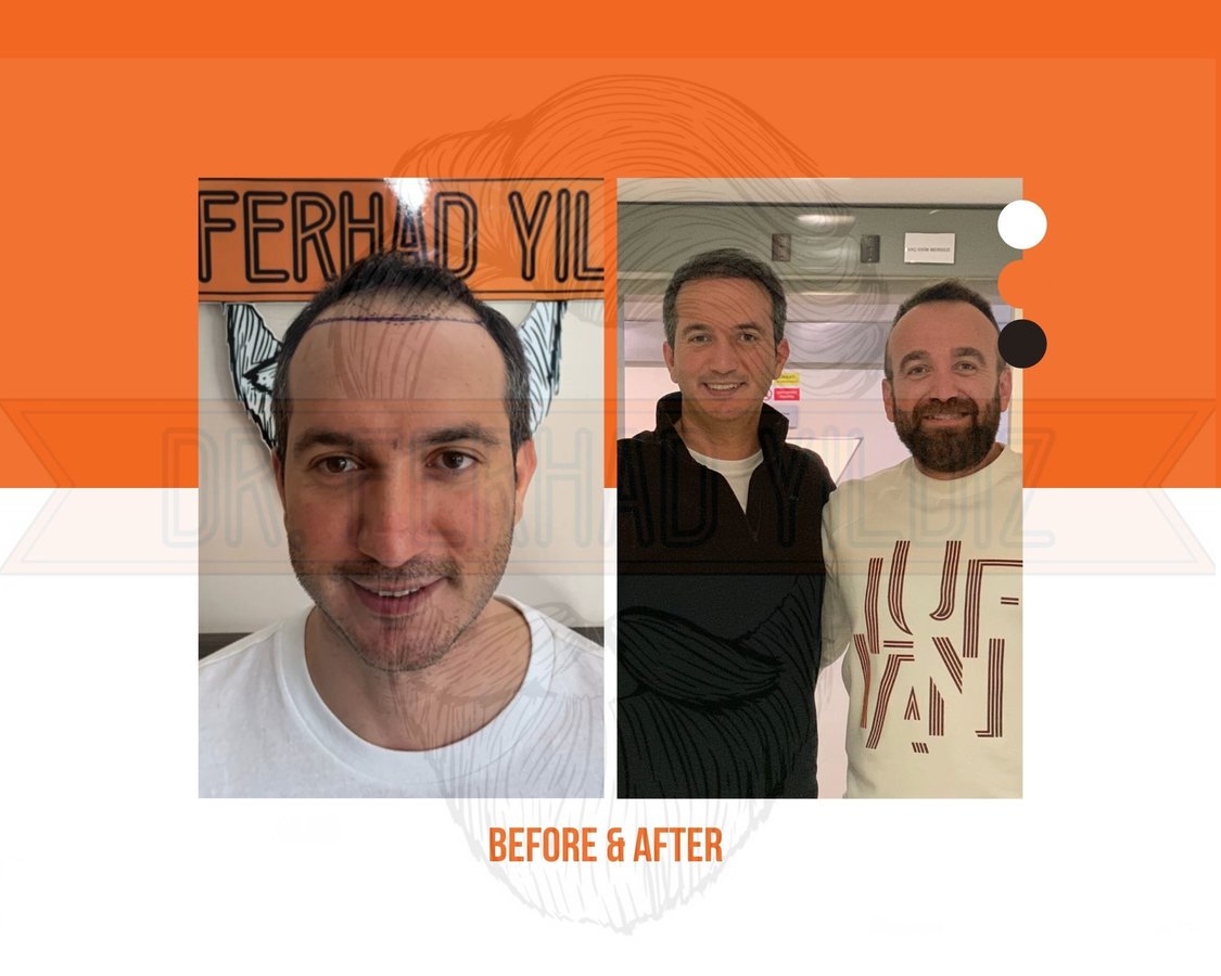 Dr. Ferhad YILDIZ - Dr. Ferhad YILDIZ