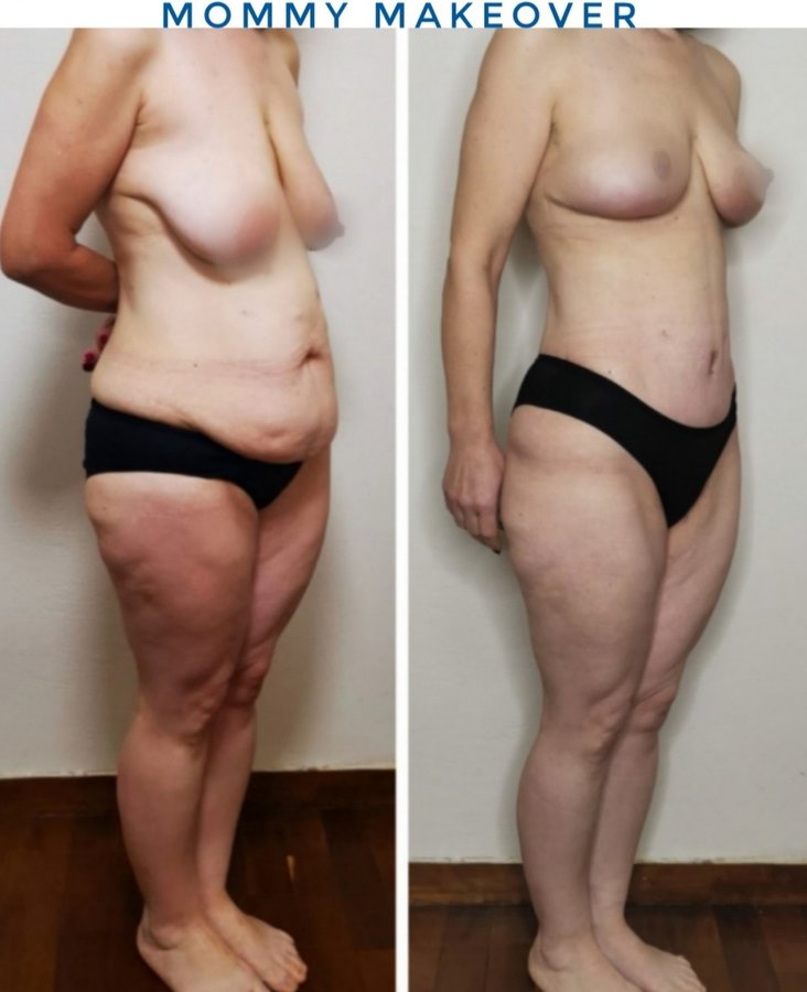 Dr Fotios Filippos Karantonis Plastic Surgery - Dr Fotios Filippos Karantonis Plastic Surgery