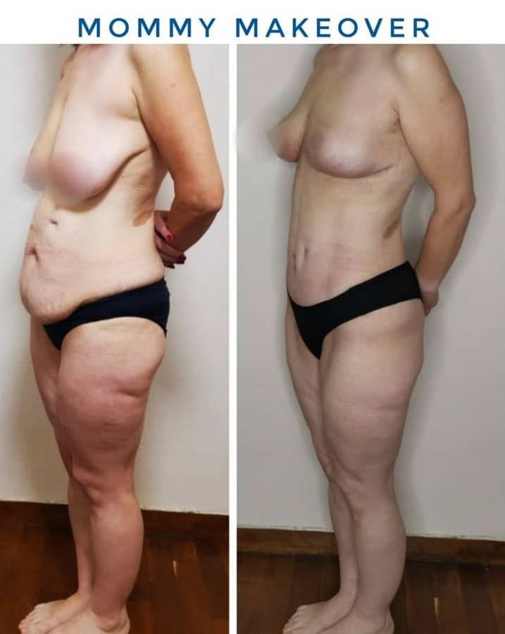 Dr Fotios Filippos Karantonis Plastic Surgery - Dr Fotios Filippos Karantonis Plastic Surgery