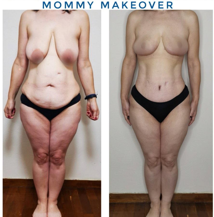 Dr Fotios Filippos Karantonis Plastic Surgery - Dr Fotios Filippos Karantonis Plastic Surgery