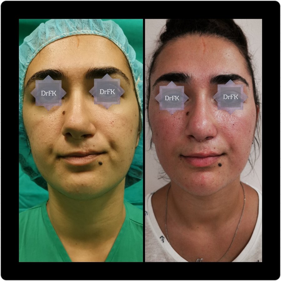 Dr Fotios Filippos Karantonis Plastic Surgery - Dr Fotios Filippos Karantonis Plastic Surgery