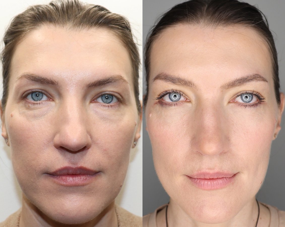 Dr Fotios Filippos Karantonis Plastic Surgery - Dr Fotios Filippos Karantonis Plastic Surgery