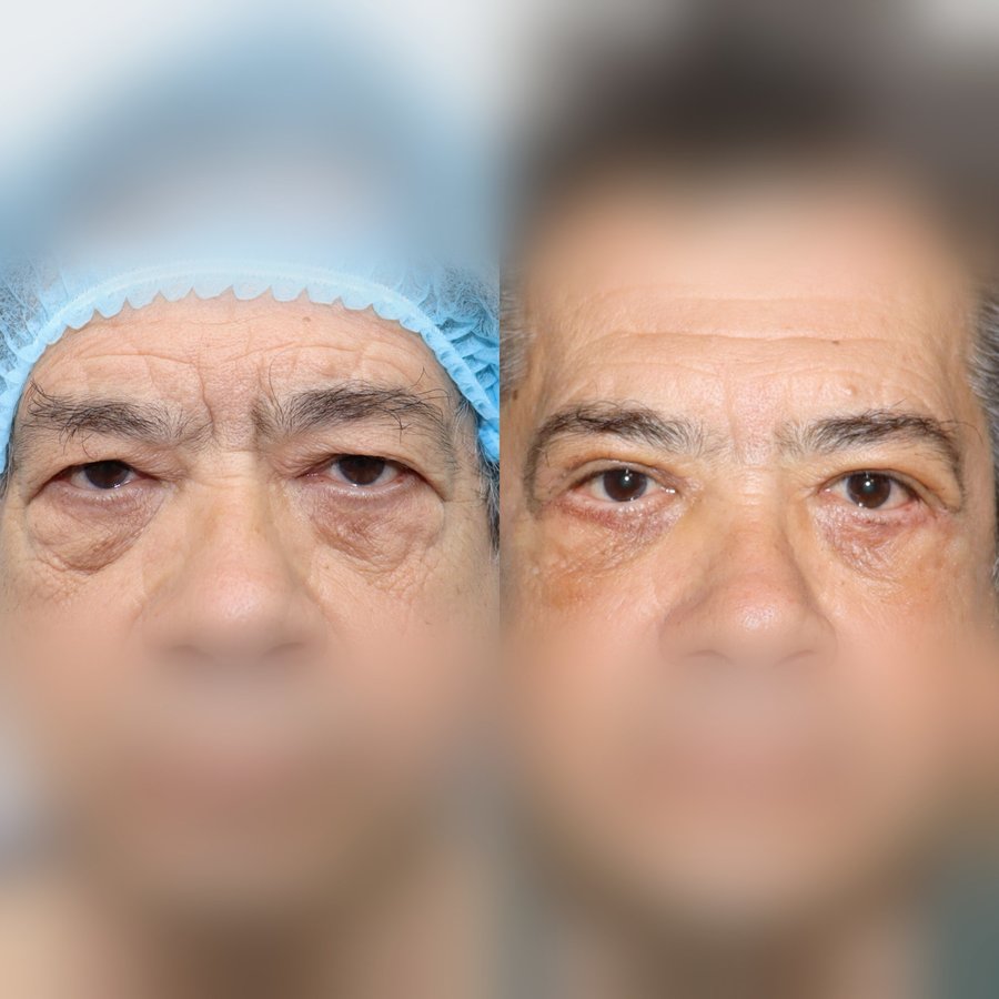 Dr Fotios Filippos Karantonis Plastic Surgery - Dr Fotios Filippos Karantonis Plastic Surgery