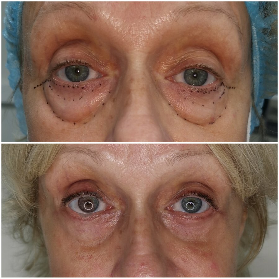 Dr Fotios Filippos Karantonis Plastic Surgery - Dr Fotios Filippos Karantonis Plastic Surgery