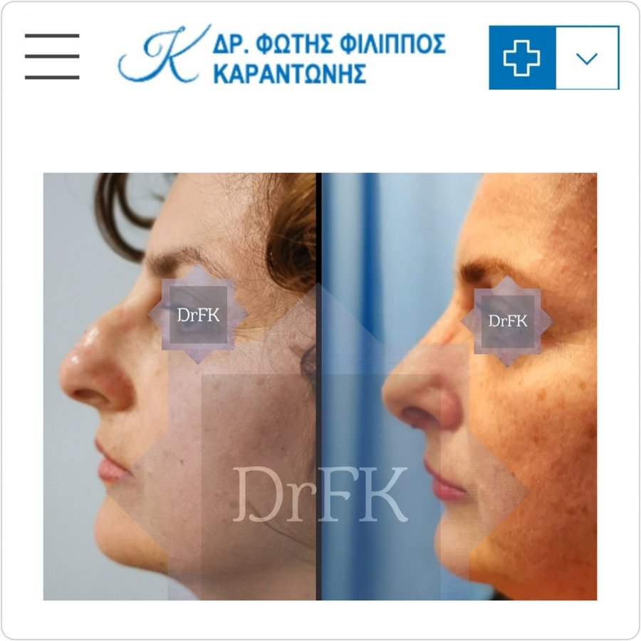 Dr Fotios Filippos Karantonis Plastic Surgery - Dr Fotios Filippos Karantonis Plastic Surgery