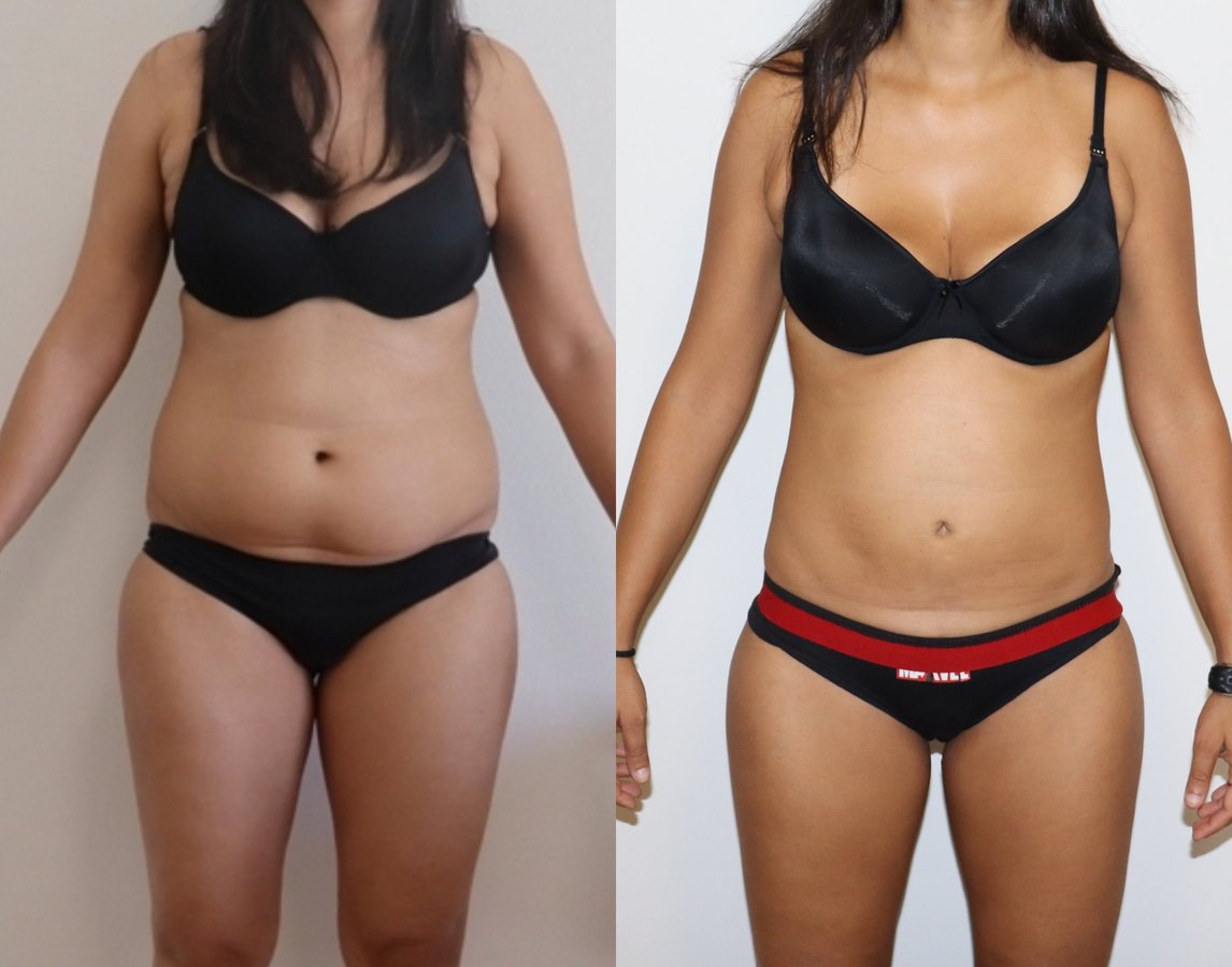 Dr Fotios Filippos Karantonis Plastic Surgery - Dr Fotios Filippos Karantonis Plastic Surgery