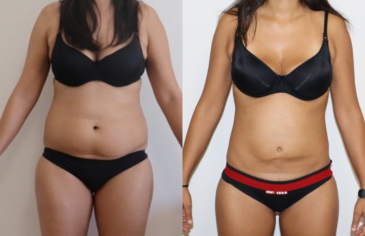 Dr Fotios Filippos Karantonis Plastic Surgery - Dr Fotios Filippos Karantonis Plastic Surgery