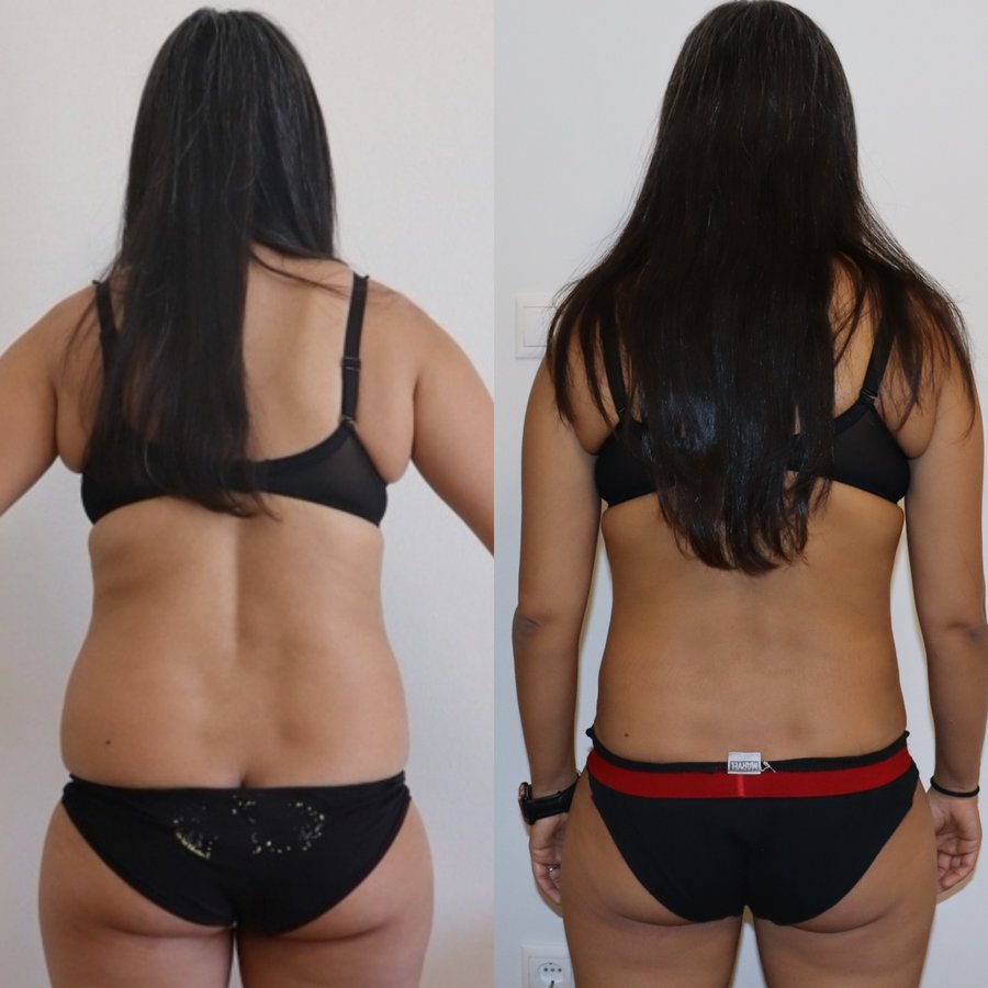 Dr Fotios Filippos Karantonis Plastic Surgery - Dr Fotios Filippos Karantonis Plastic Surgery