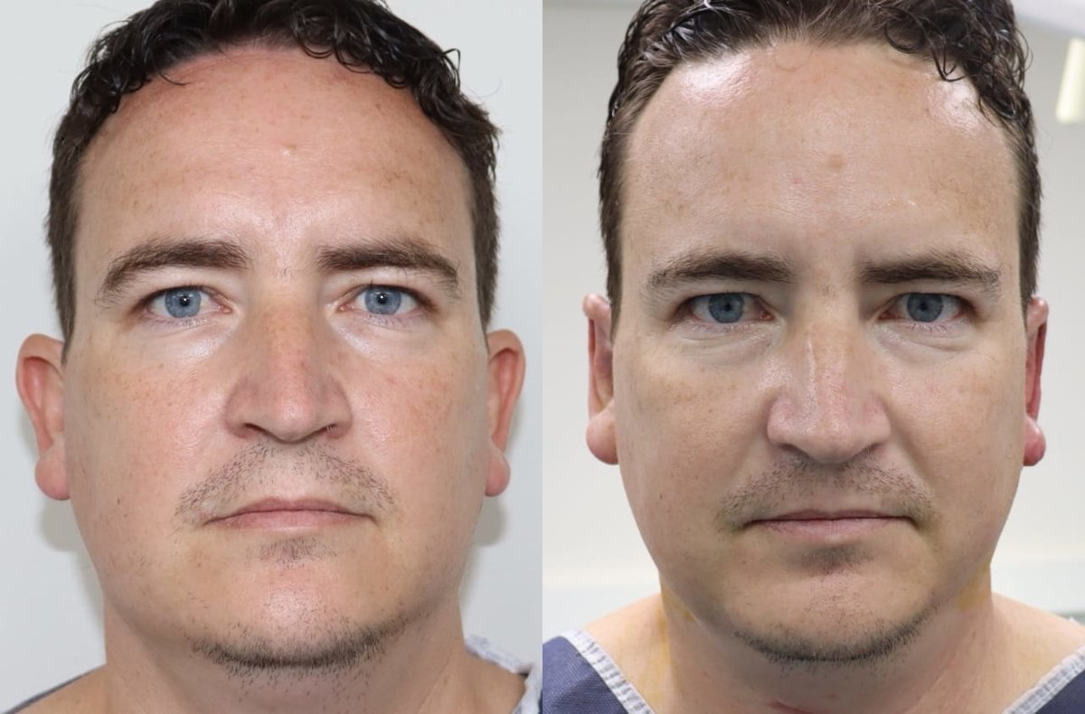 Dr Fotios Filippos Karantonis Plastic Surgery - Dr Fotios Filippos Karantonis Plastic Surgery