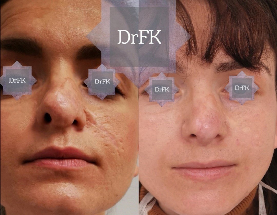 Dr Fotios Filippos Karantonis Plastic Surgery - Dr Fotios Filippos Karantonis Plastic Surgery